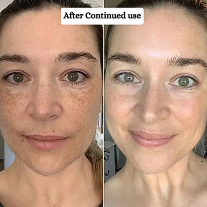 Collagen Hydrogel Mask